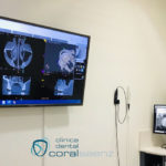 CBCT