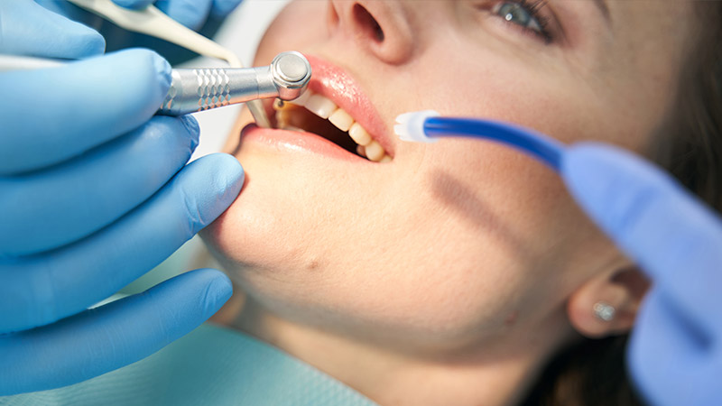 Endodoncia en Alberite