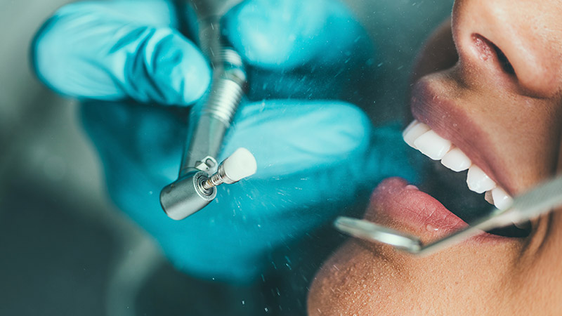 Estética Dental en Alberite